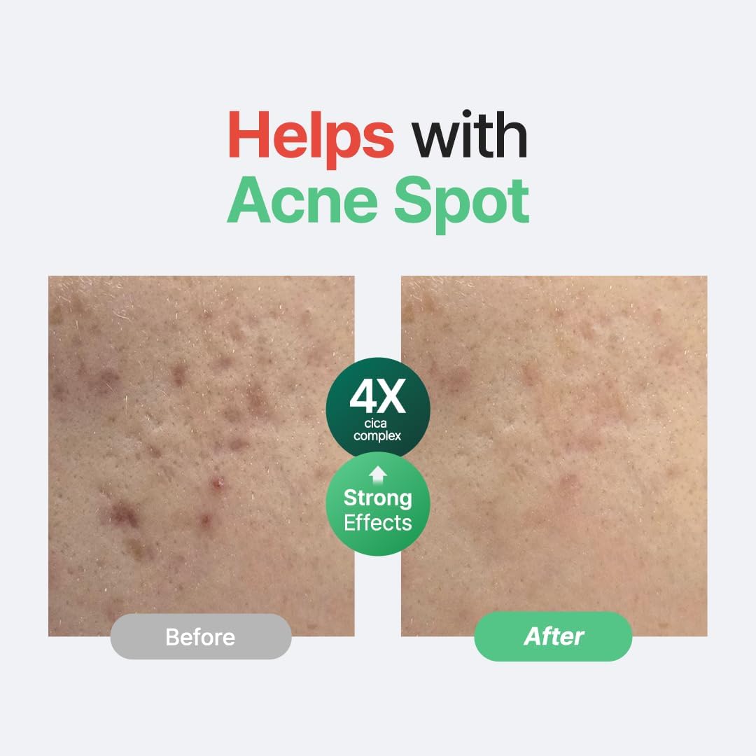 PURITO Seoul Wonder Releaf Centella Serum Unscented 60ml