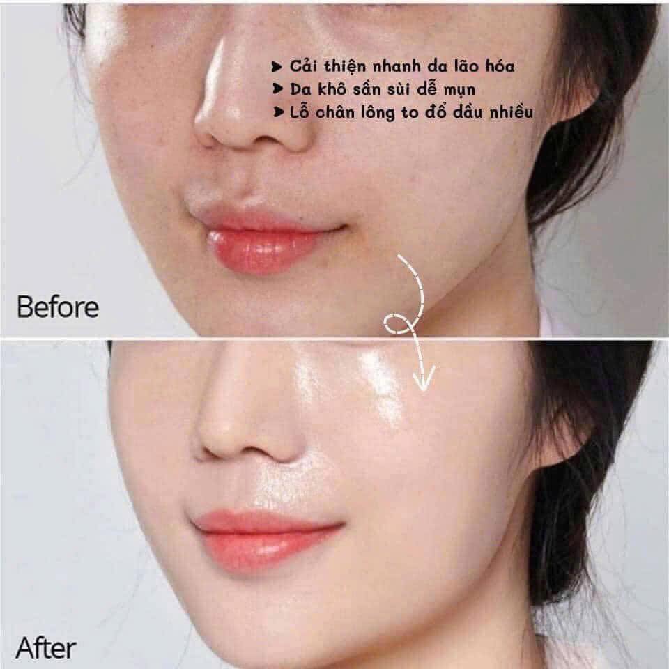 OHUI EXTREME WHITE 4 pcs