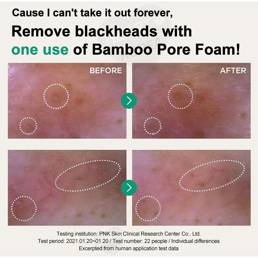 BRINGGREEN Bamboo Charcoal Pore Purifying Cleansing Foam 300ml