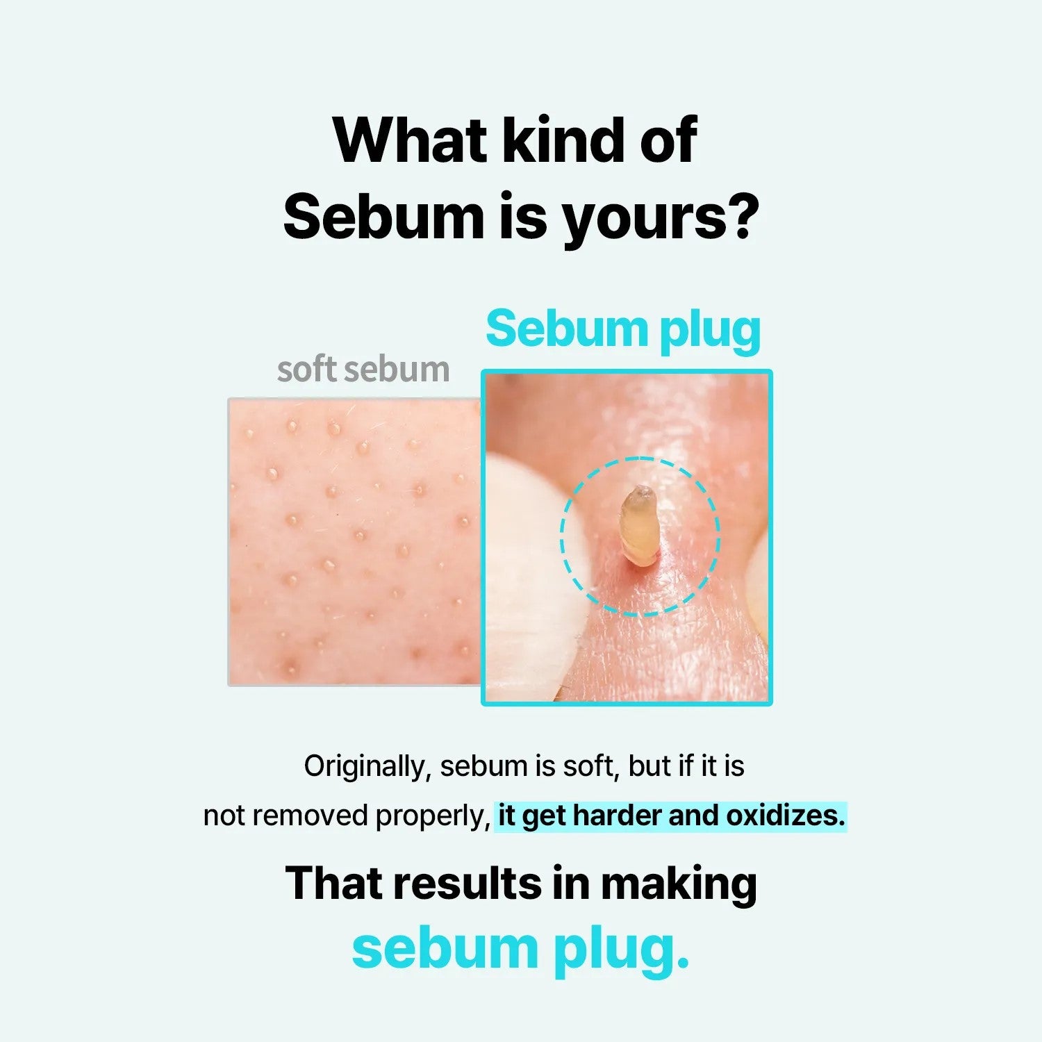 ILSO Super Melting Serum Softener 150ml + Deep Clean Master - 1pc Set