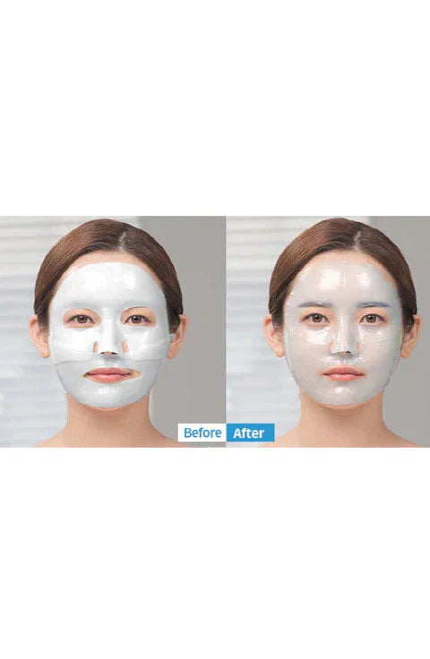 MediAnswer Vita Collagen Mask - Box of 5 Masks (37 g / 1.3 oz Each)