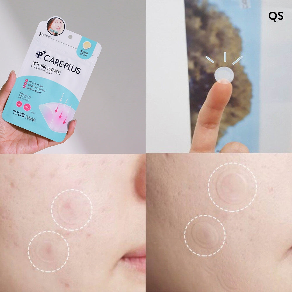 Care Plus Scar Cover Spot Patch 102pcs
